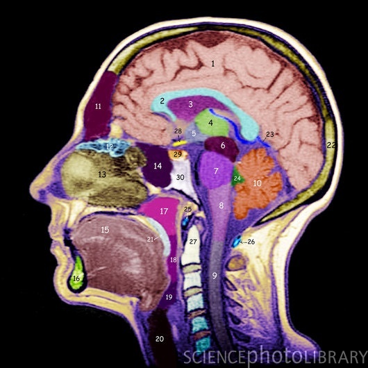 An MRI of the head with the various part of the brain numbered.  See the blog post for the relevant bits! (SGO/Science Photo Library)